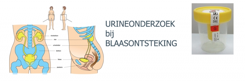 Urine Onderzoek Bij Blaasontsteking – Medistate